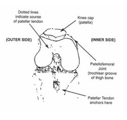 Anterior Knee Pain - Corporate